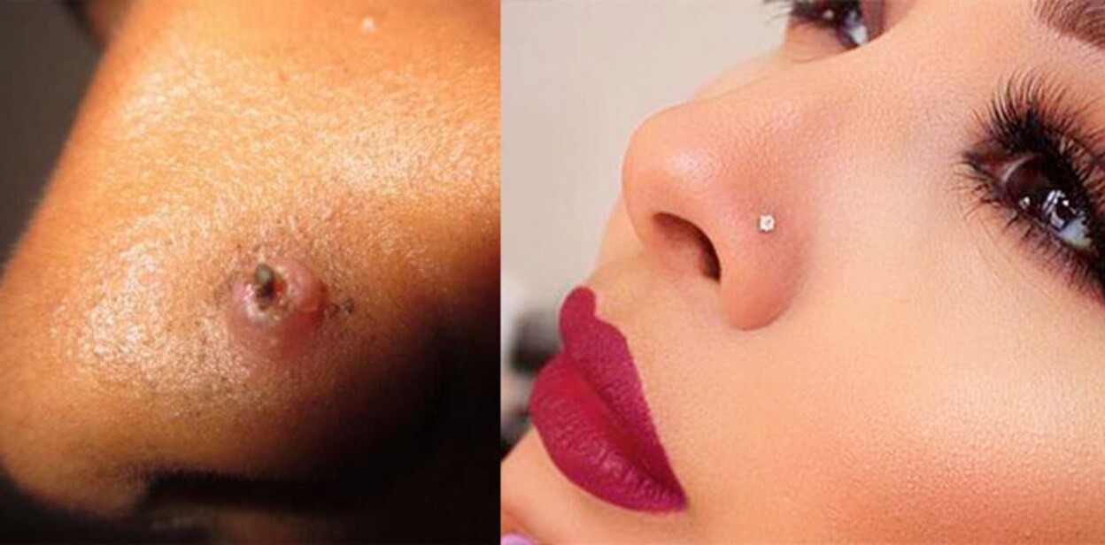 nose