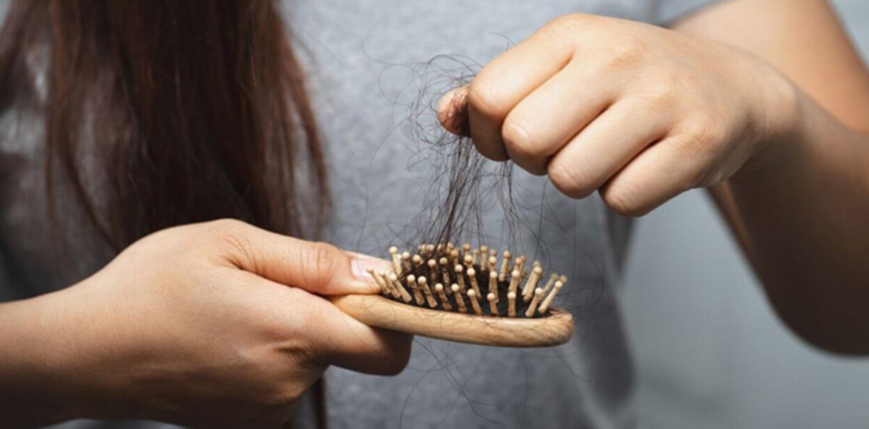 hair-lossayurvvvv556677