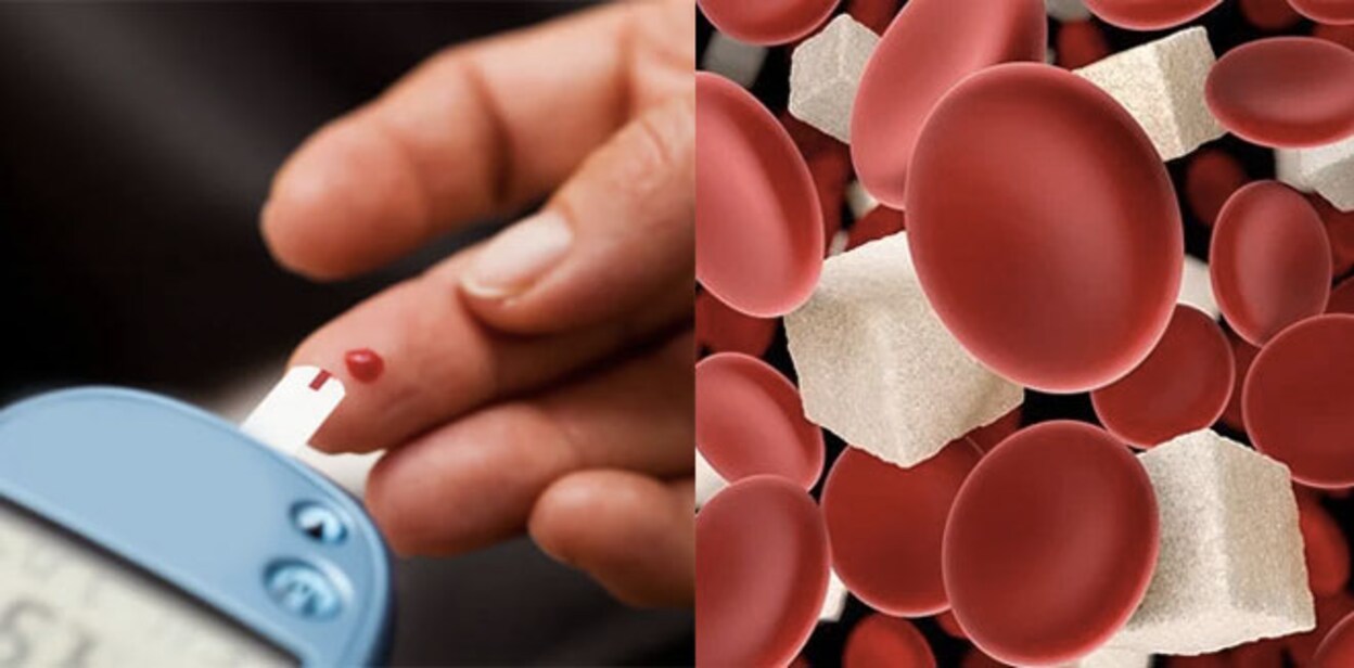 blood-check