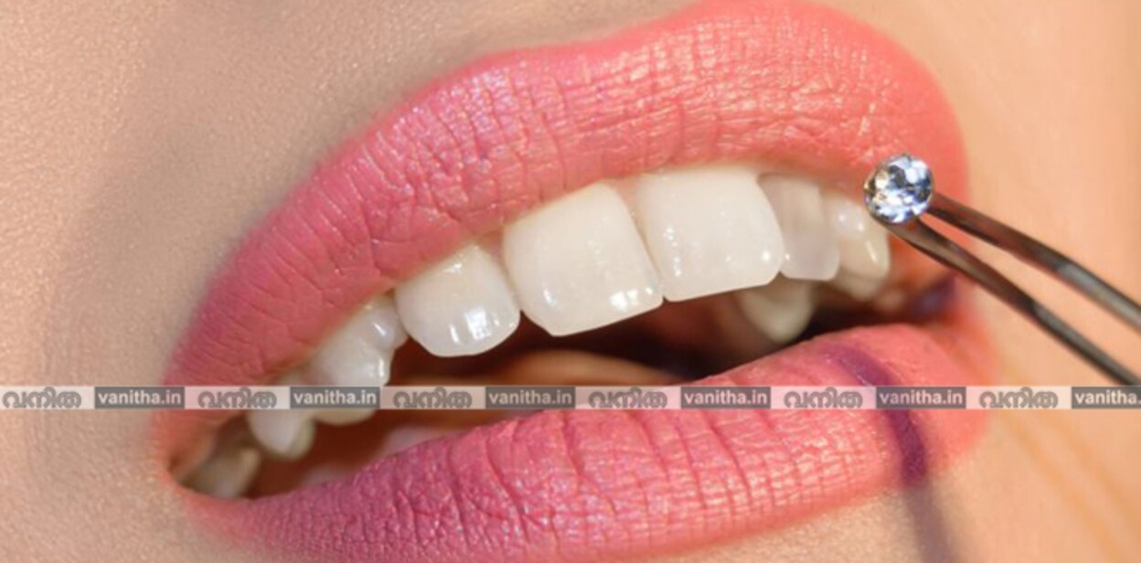 Tooth-Jeweller