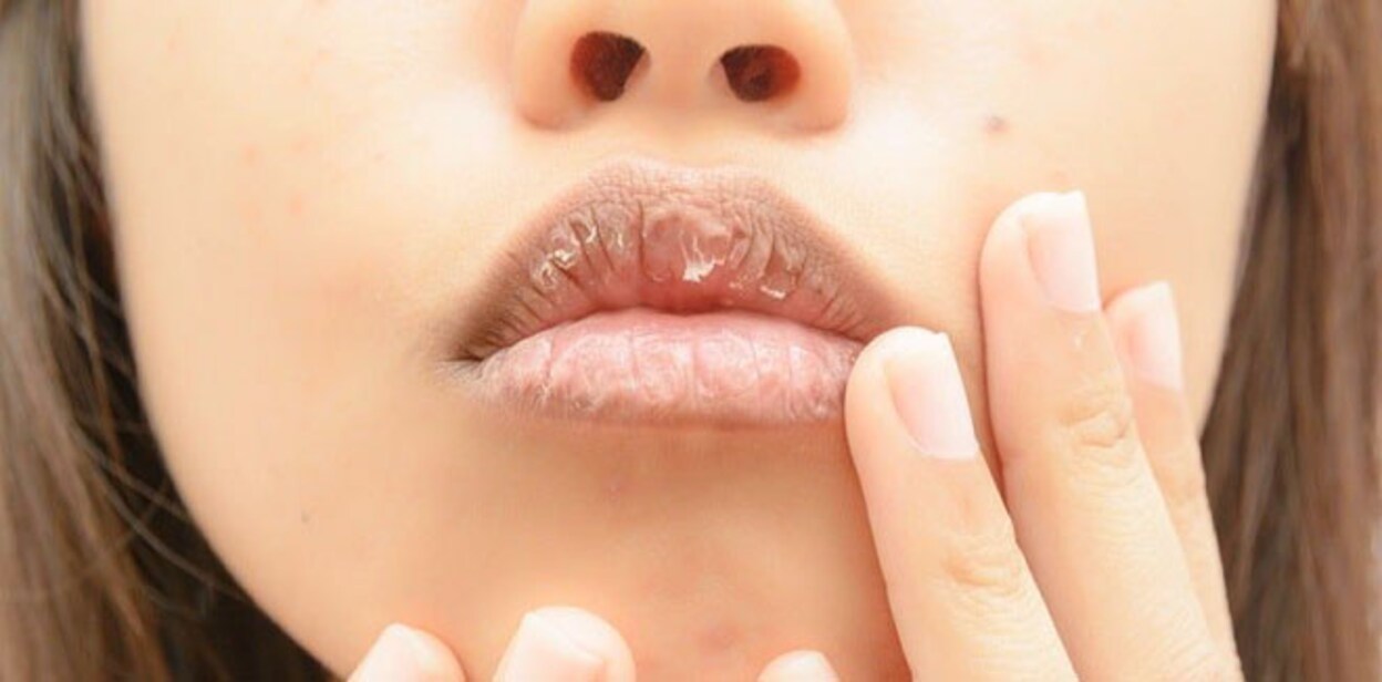 lip-fate