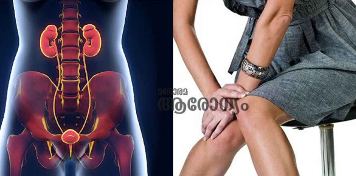 urine-infec