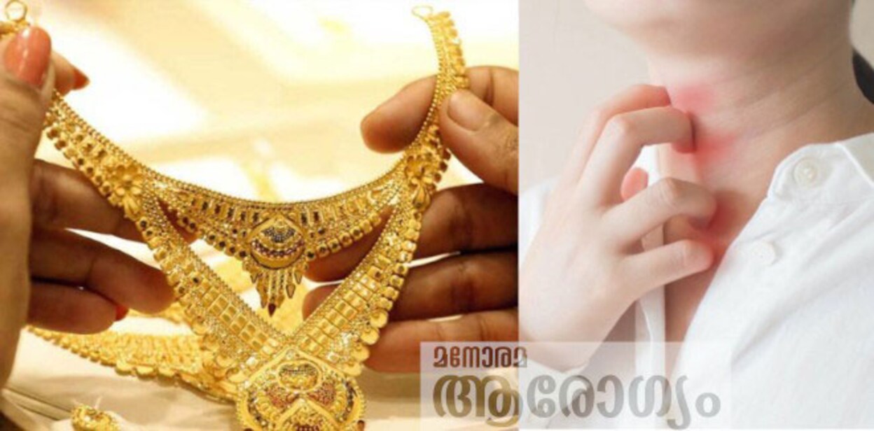 gold-allergy