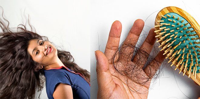 hair-loss-solution
