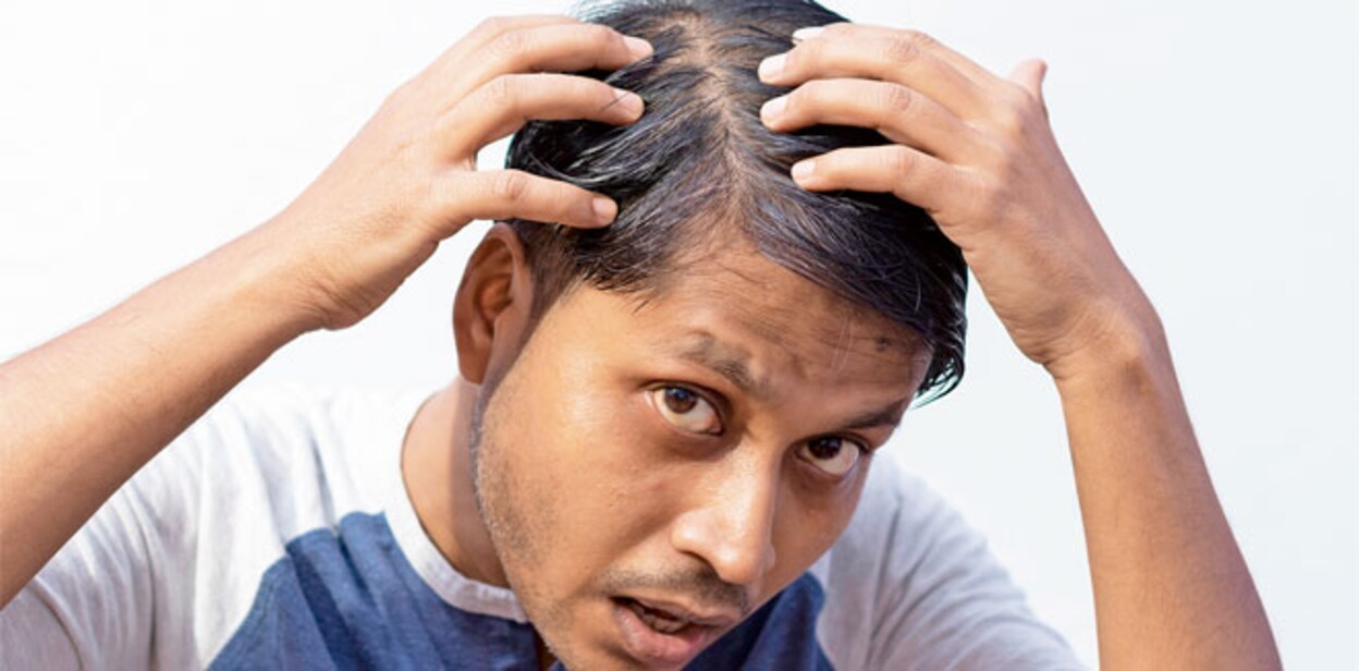 grey-hair-