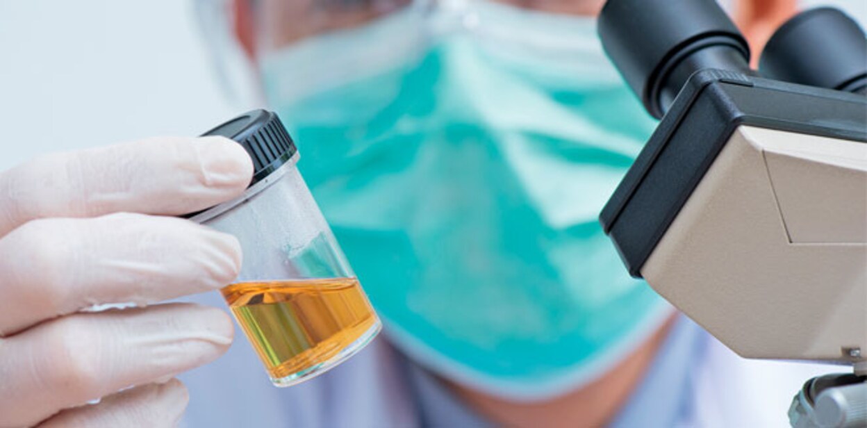 urine-test