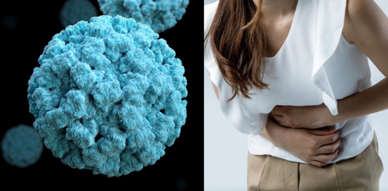 norovirus445