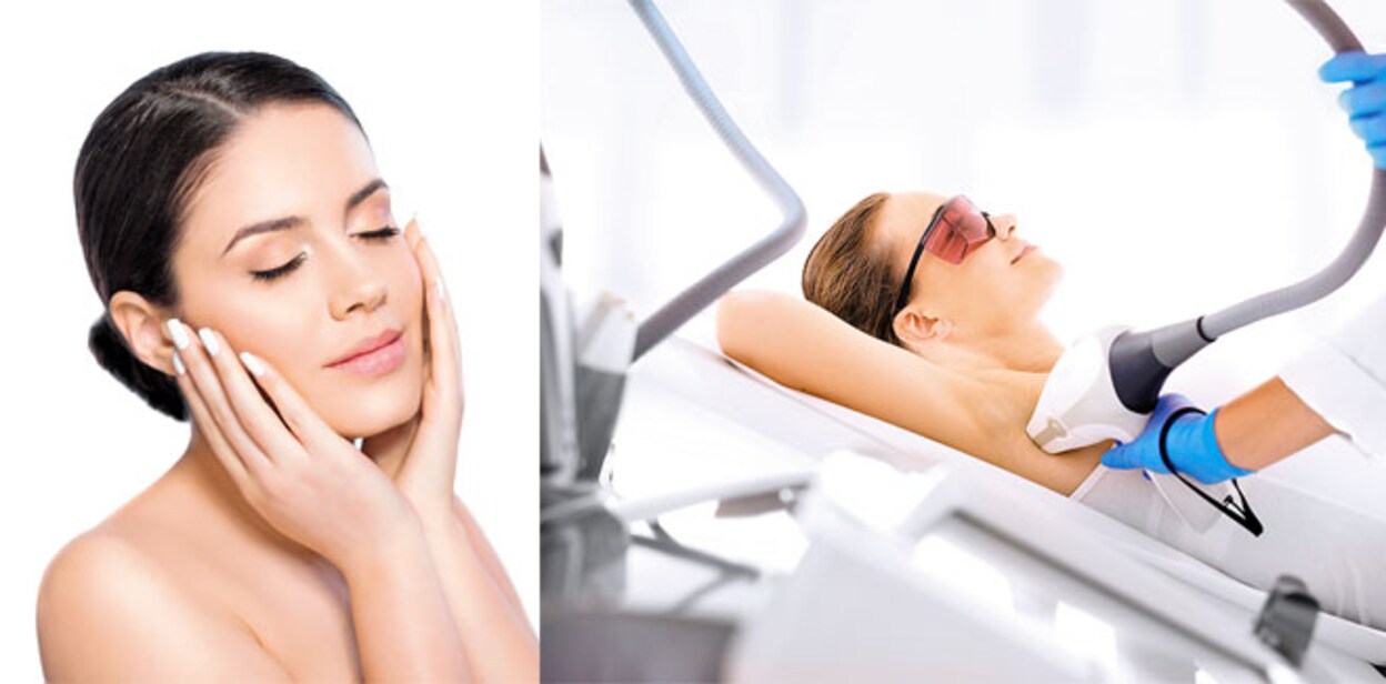 laser-treatments