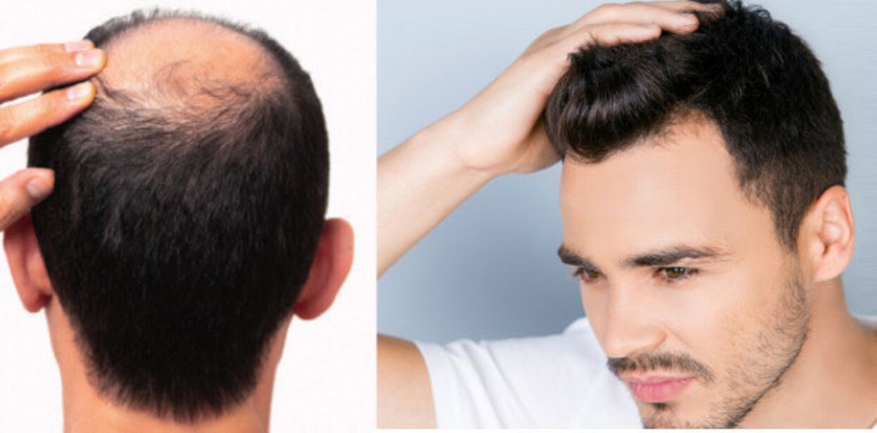 hair-fixing-cover