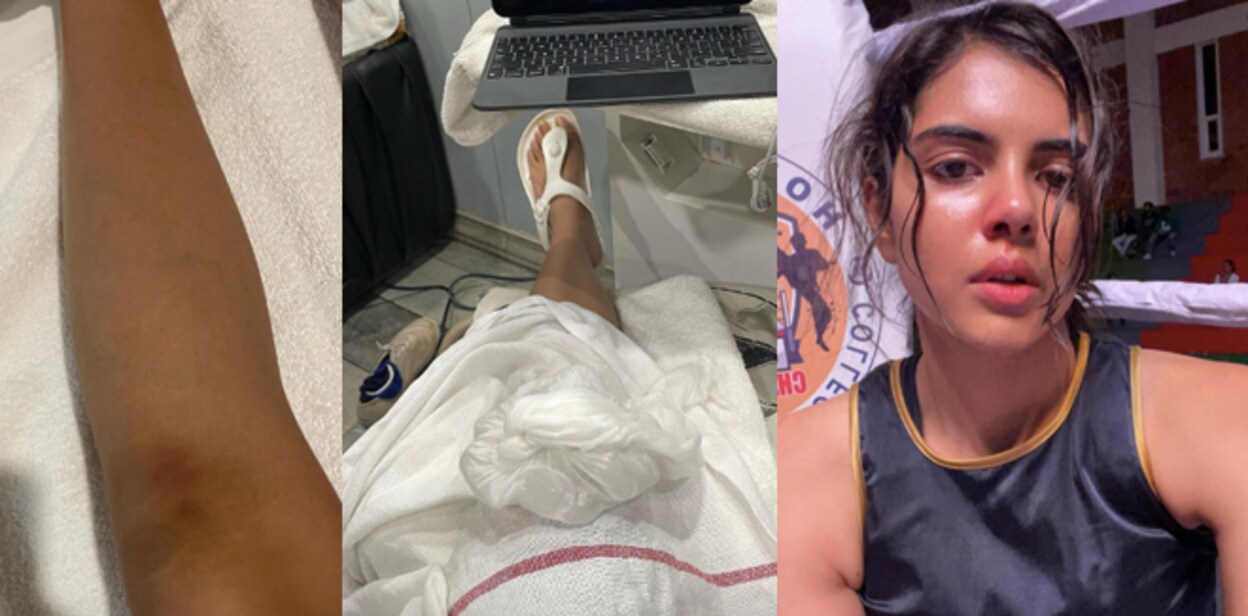 kalyani-accident