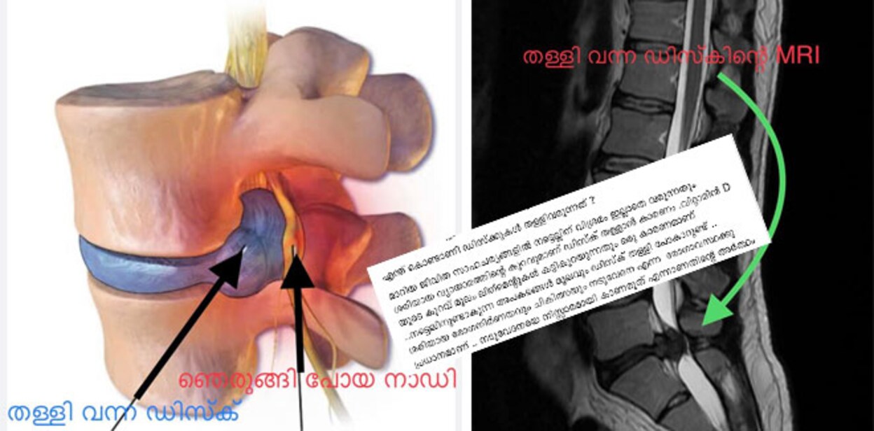 spine-problenm