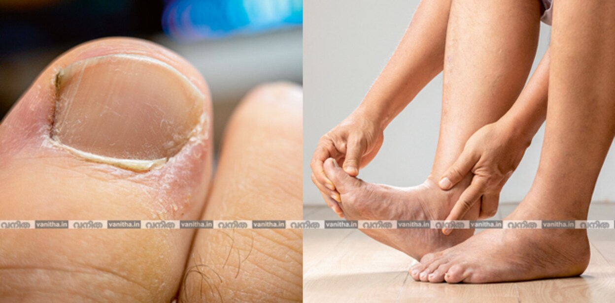 feet-health677