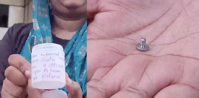 കടുത്ത വയറുവേദന, ആരോഗ്യസ്ഥിതി മോശം; ശസ്ത്രക്രിയയ്ക്കിടെ പതിനാലുകാരന്റെ വയറ്റിൽ സർജിക്കൽ ക്ലിപ്പ് കുടുങ്ങി, പരാതി