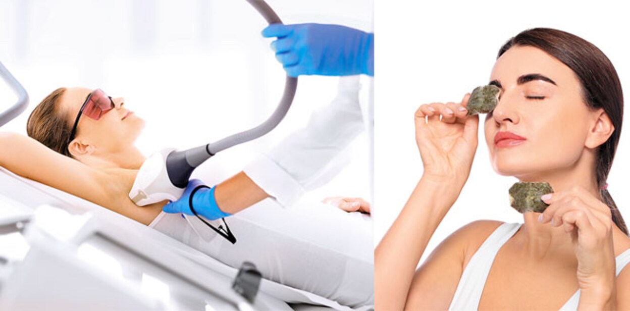 laser-treatment