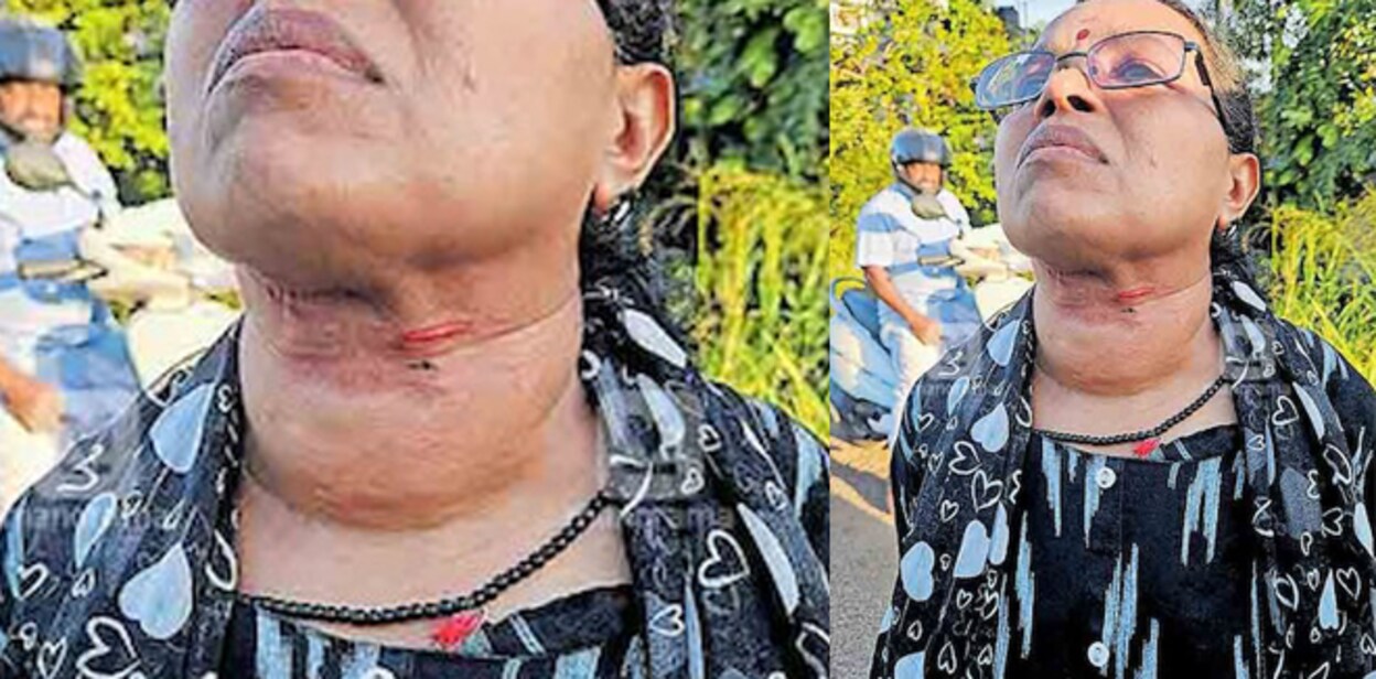 cable-wire-on-neck