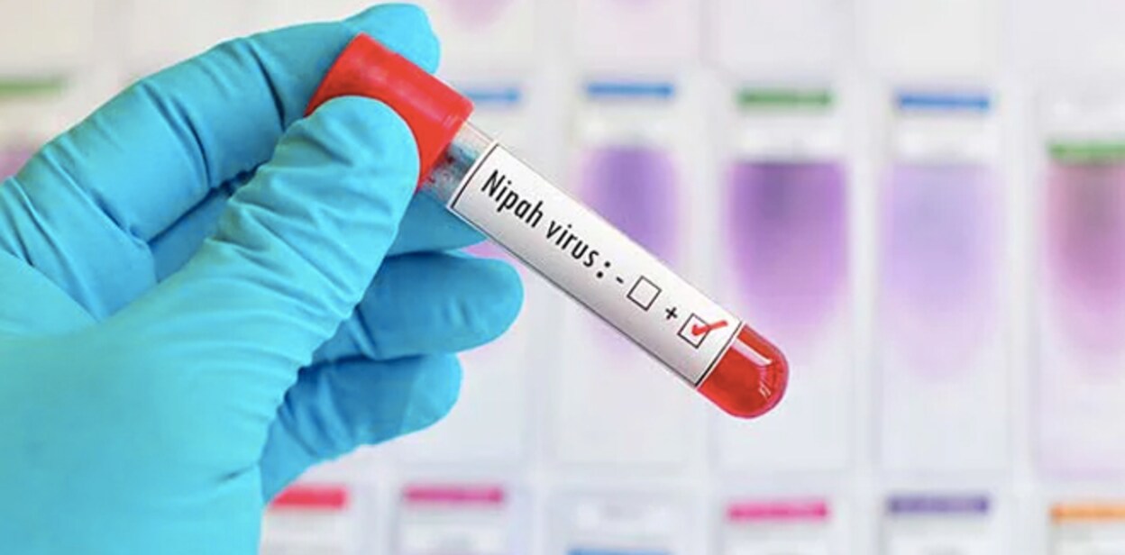nipah-viruss466yg