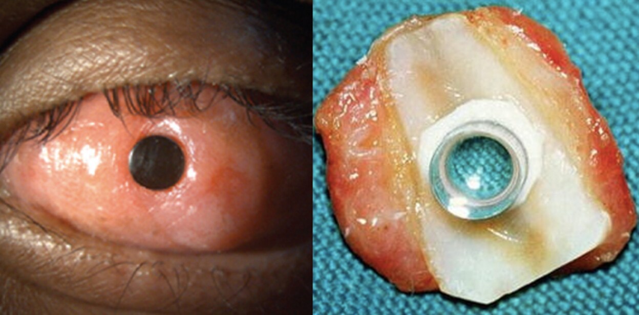 eyeddfghbh789