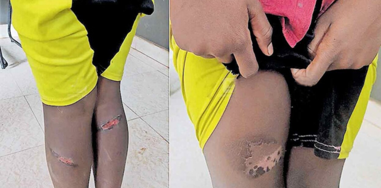palakkad-mannarkadu-cruelty-of-father