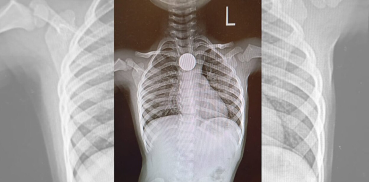 coin1