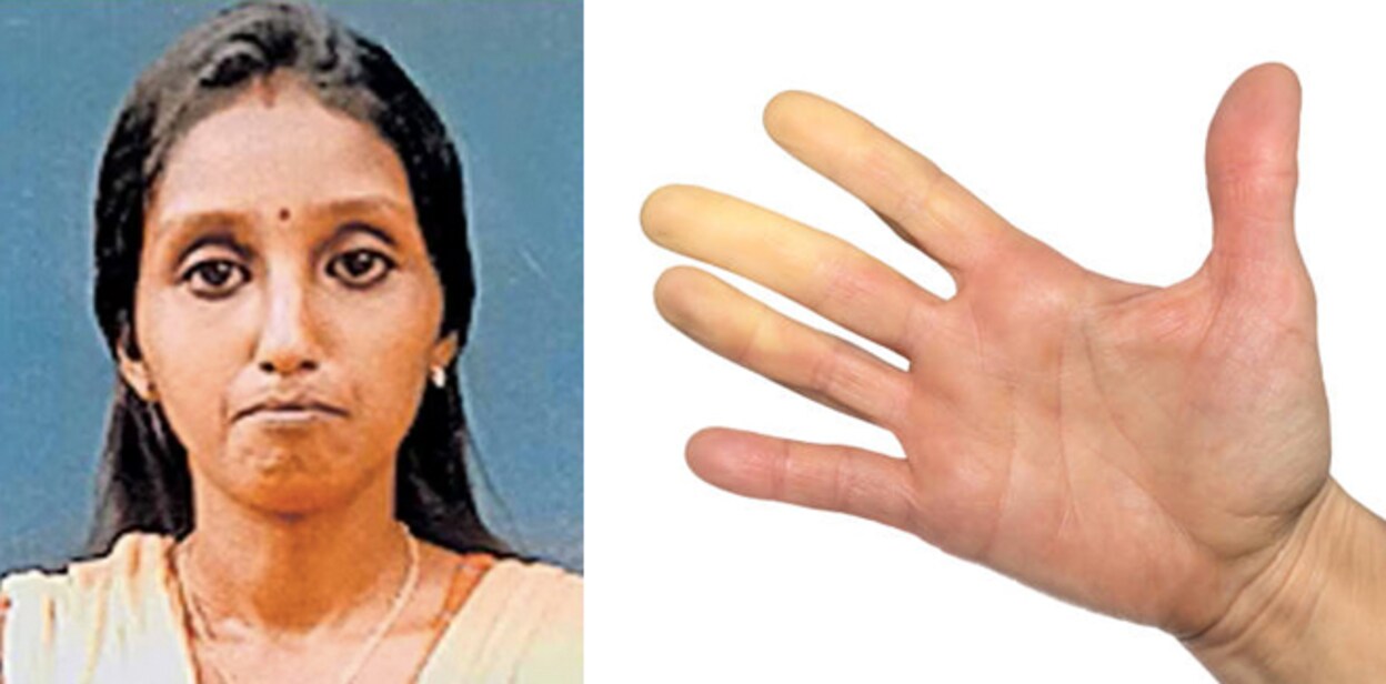 aswathy-crisis