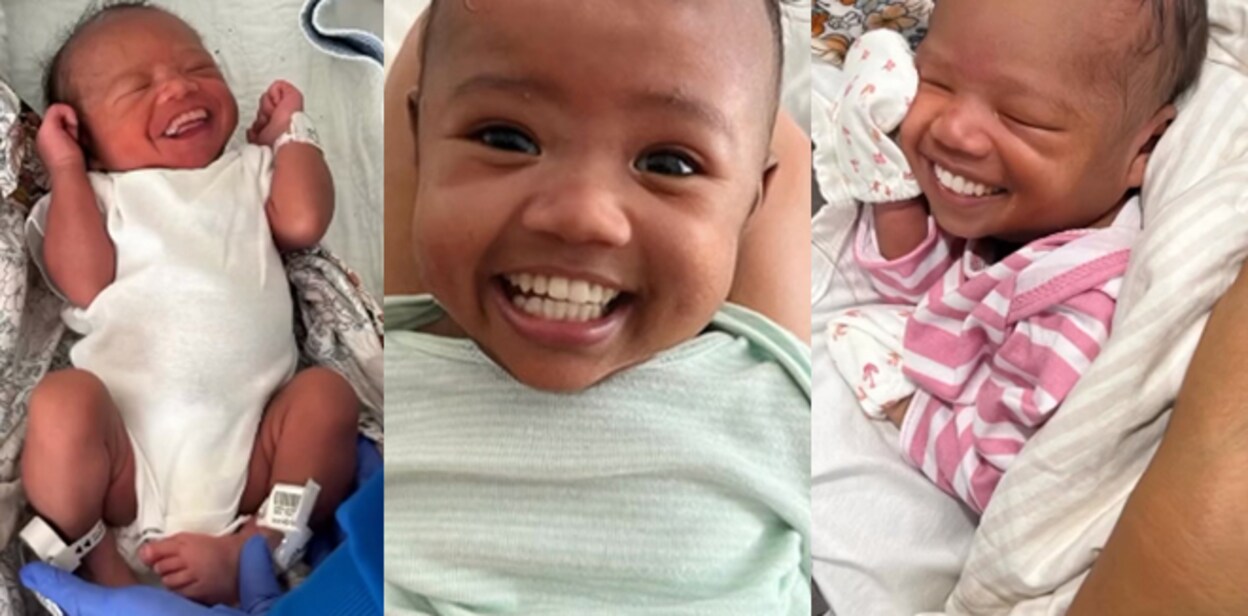 baby-born-with-32-teeth