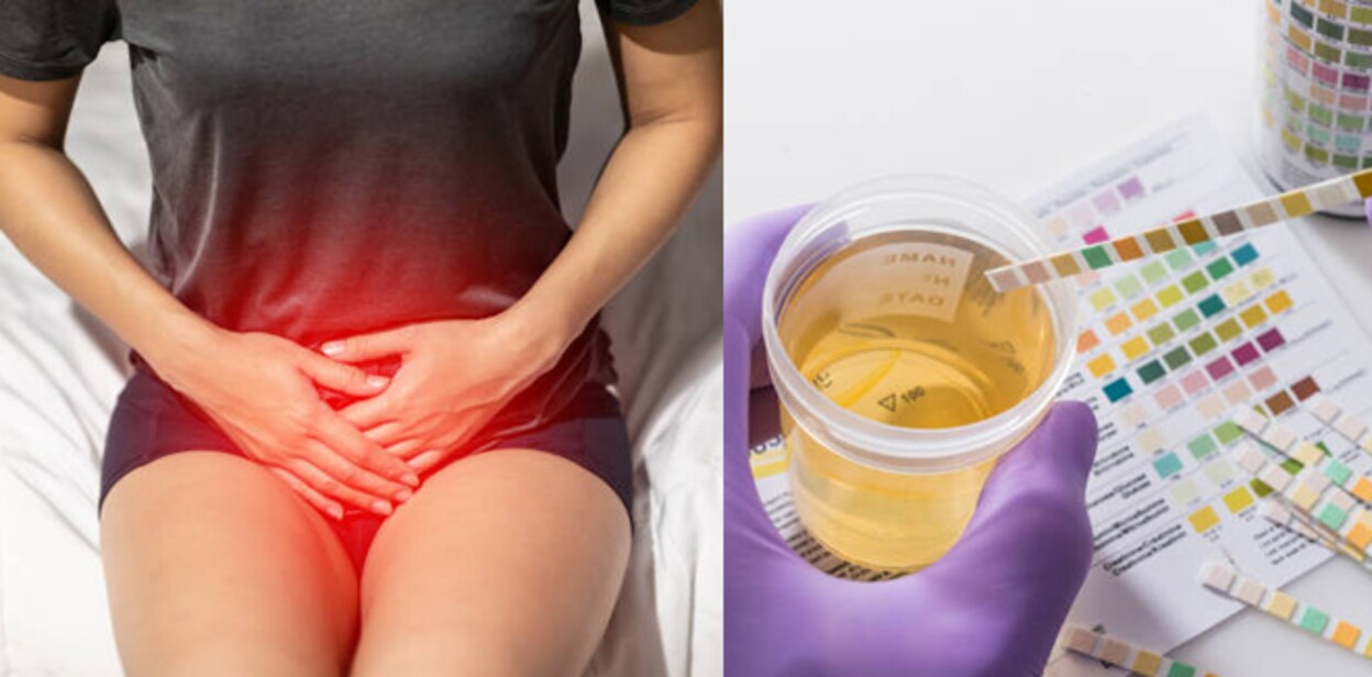 urinary-inff567