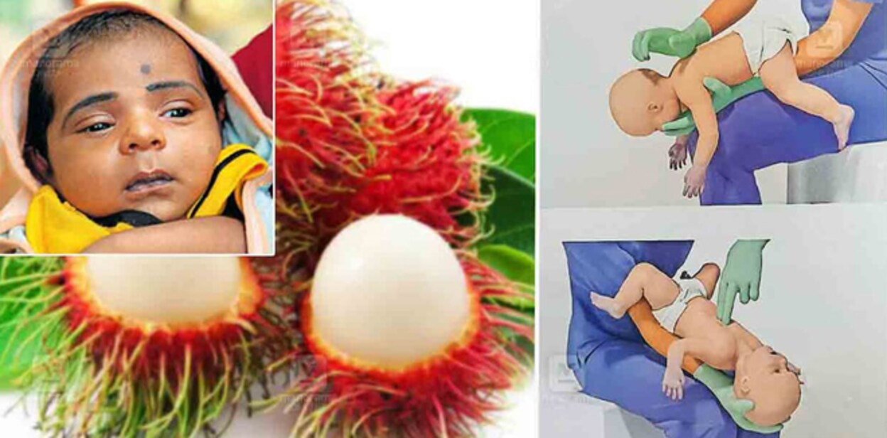 baby-rambutan-choking-kallambalam