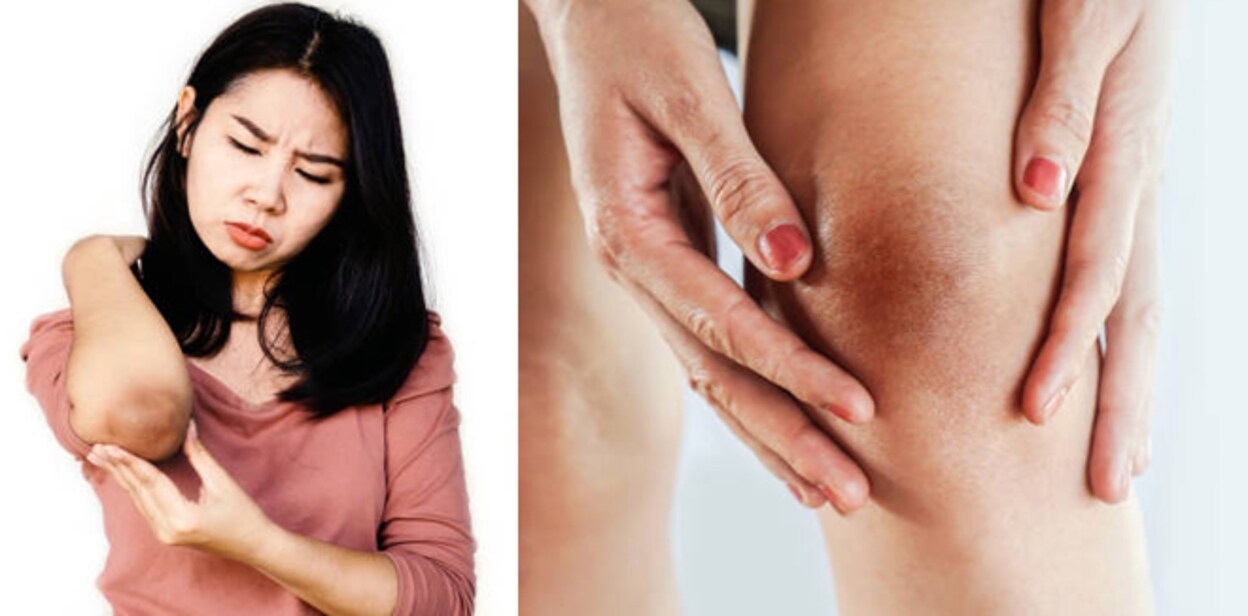 dark-knee