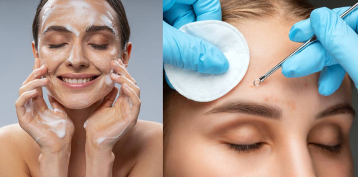 face-clean-up