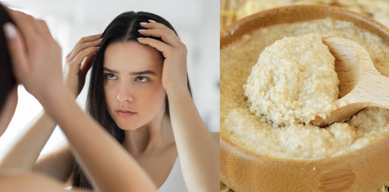 dandruff-899hhj