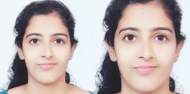 ‘മിനി ലോറിയിടിച്ച് സ്കൂട്ടര്‍ റോഡിലേക്ക് വീണ് തലയ്ക്ക് ഗുരുതര പരുക്ക്’: നഴ്സിന് ദാരുണാന്ത്യം, അമ്മ പരുക്കുകളോടെ ആശുപത്രിയിൽ