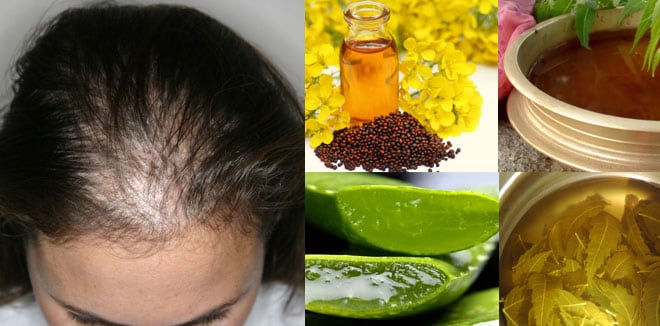 hair-loss-problem