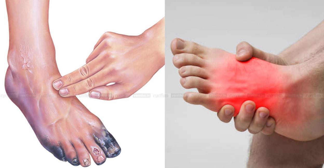 5-leg-health-problems-needing-immediate-medical-attention