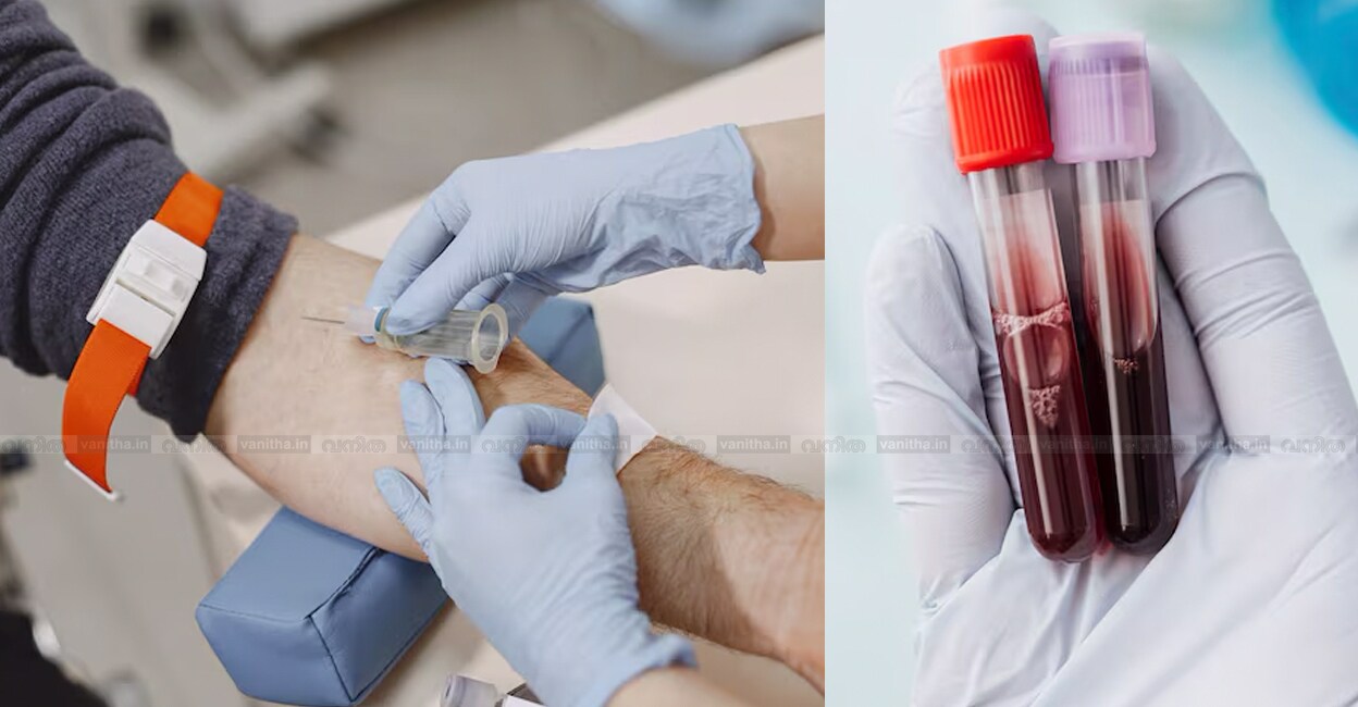 Health-checkup-story