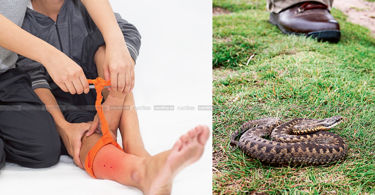 snake-bite-story-alert-tips