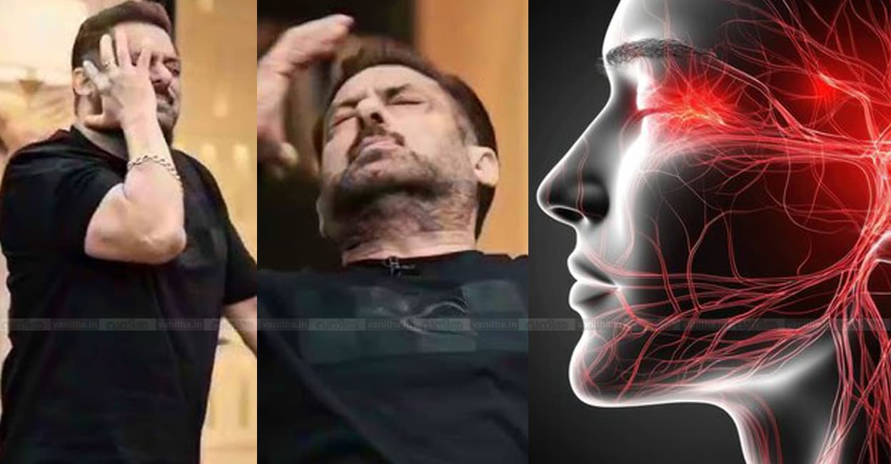 trigeminal-neuralgia-facial-pain-nerve-disorder