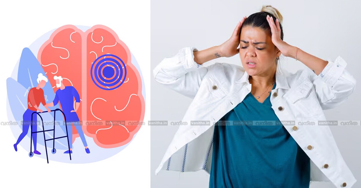 stroke-immediate