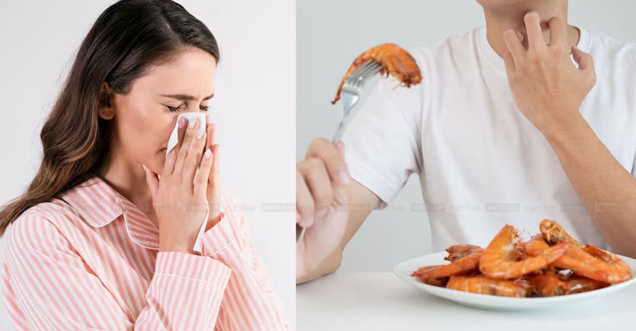 food-allergy-symptoms