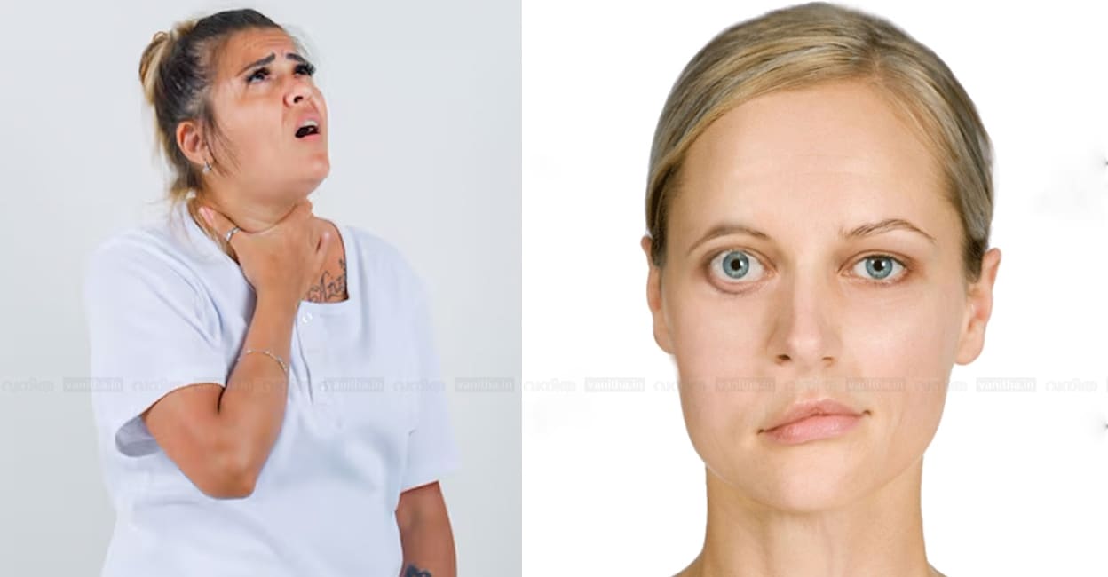 signs-symptoms-myasthenia-gravis