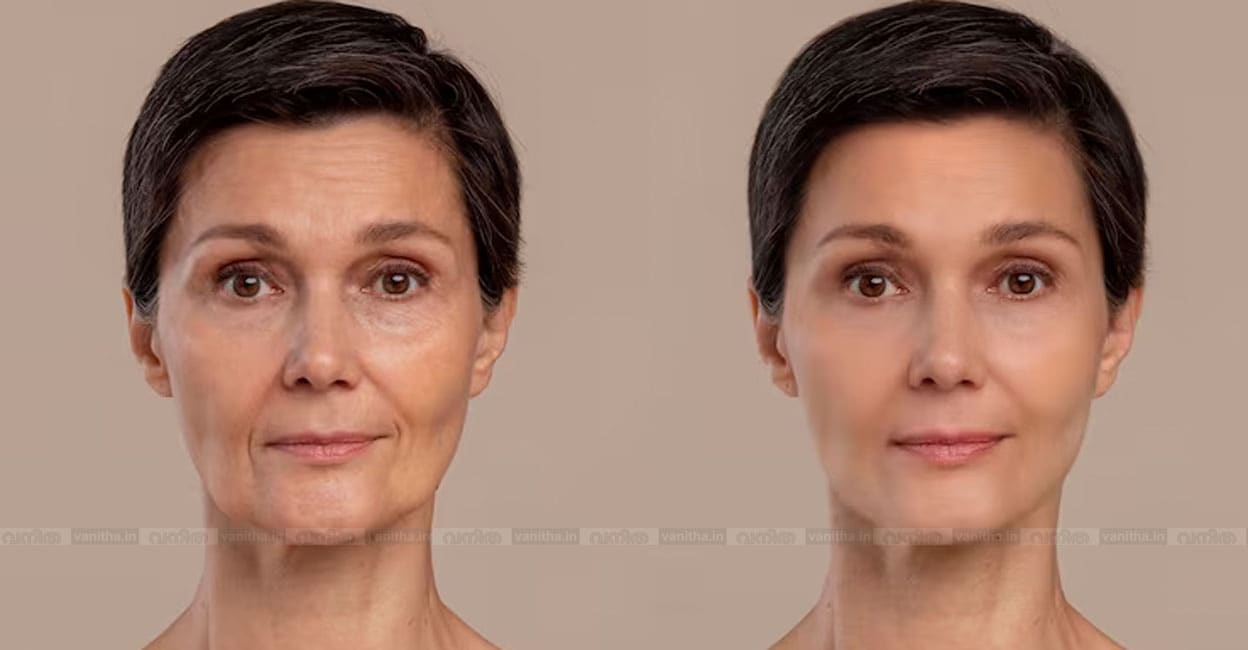 antiaging-beauty-treatment