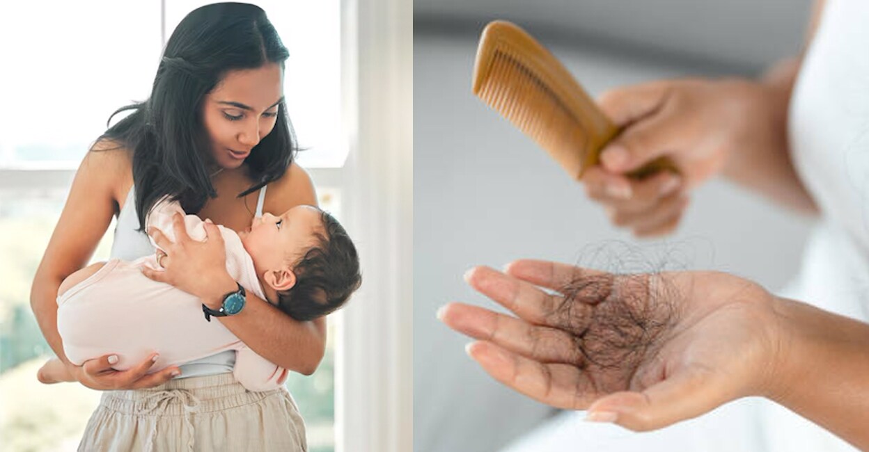 Understanding-Postpartum-Hair-Loss