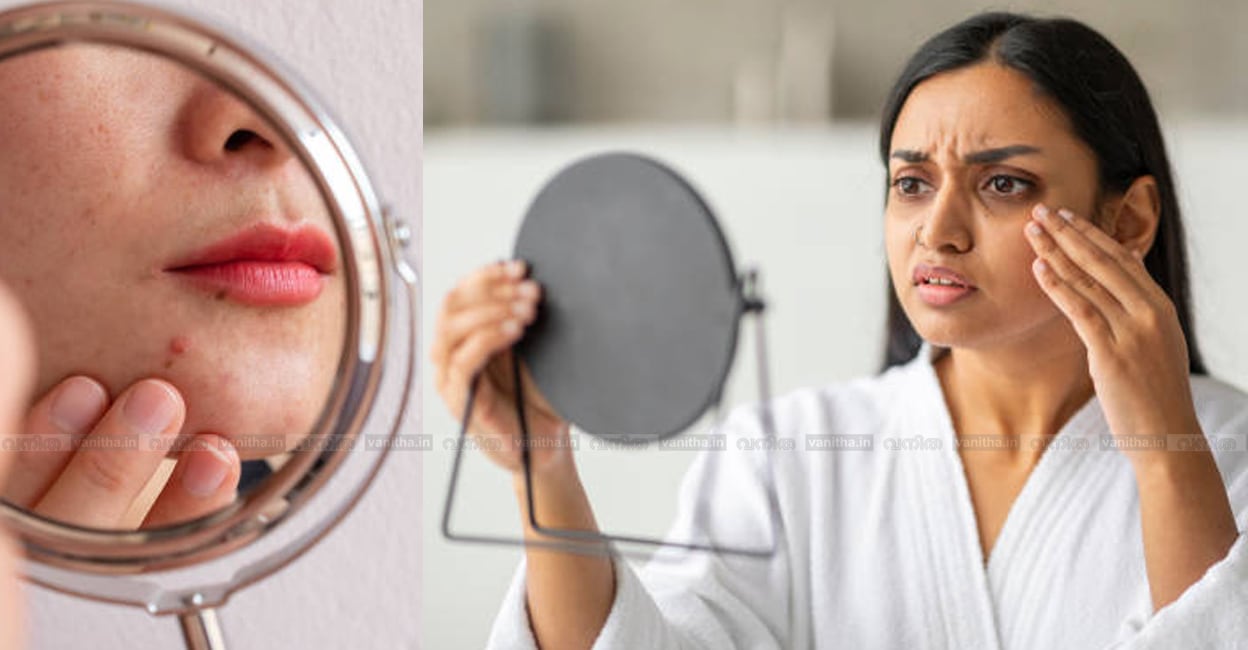 health-risks-types-of-skin-darkening