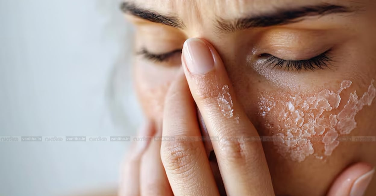 closeup-womans-dry-skin