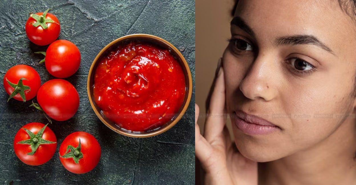 pore-acne-scars-natural-remedies