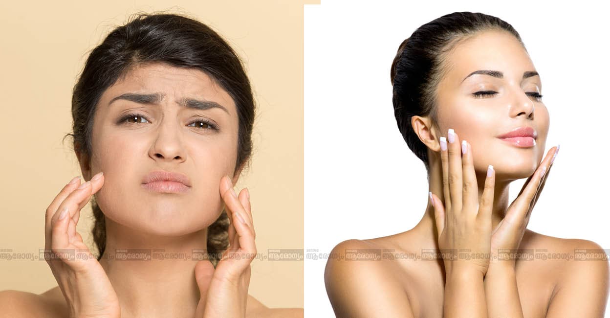 skin-repair-treatments