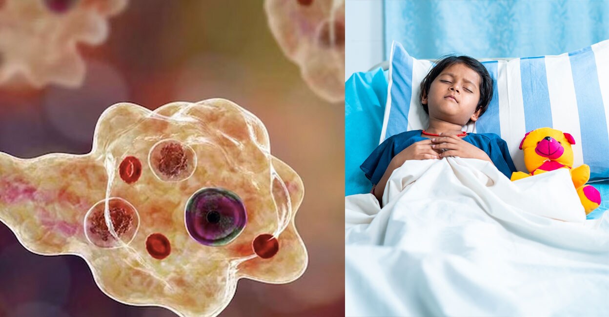 amoebic
