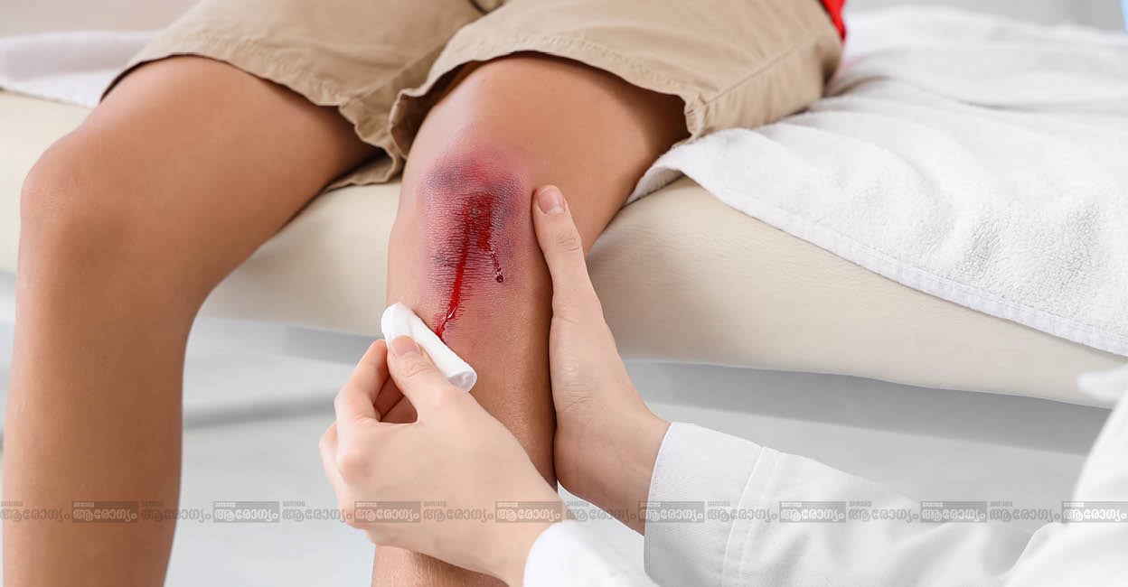wound
