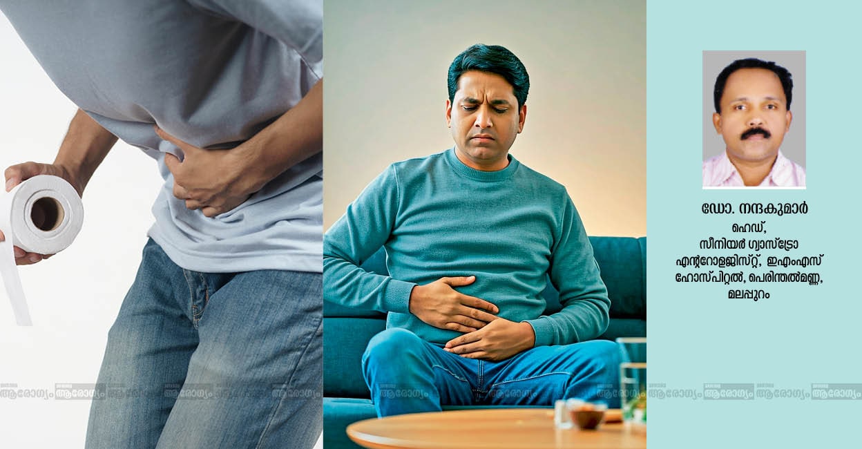 ibs-diseases