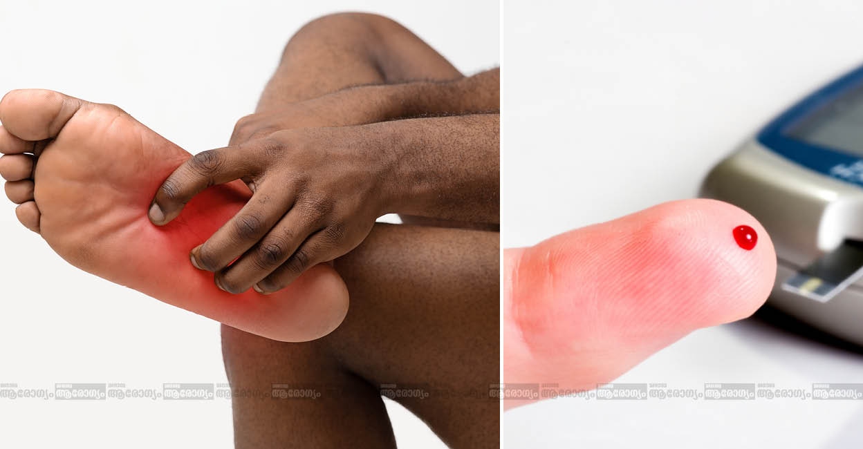 diabetic-foot