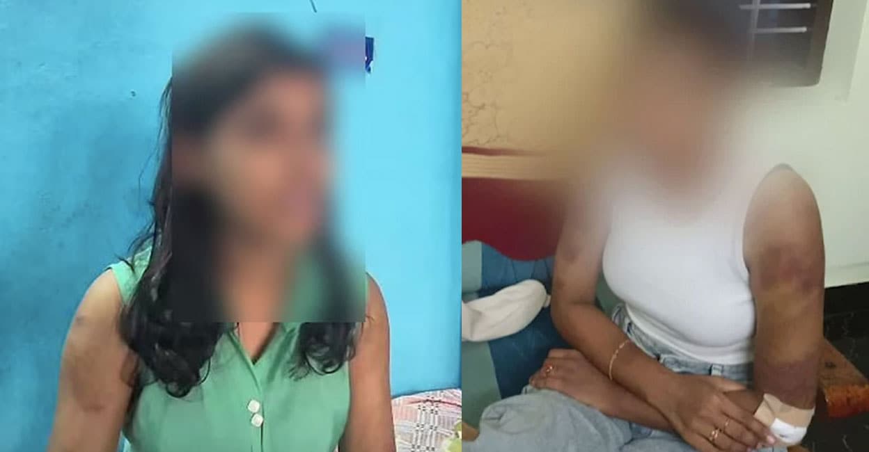 kollam-bride-attacked